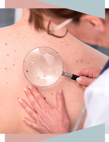 Citamos algumas doenças da pele mais comuns: